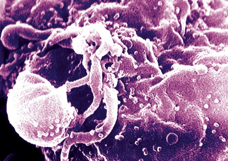 Scientists successfully cure two people of HIV using stem cell therapy